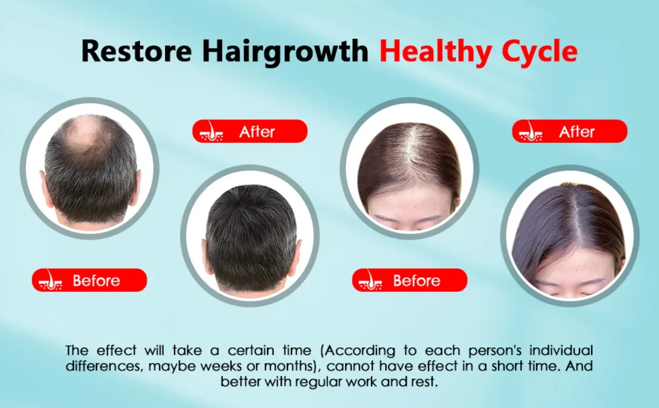 Перезаряжаемая шапочка для рос – обзор и цена Hair Care Basic