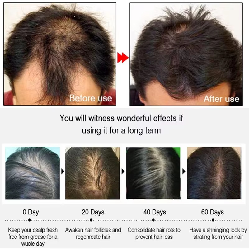Спрей для быстрого роста волос – обзор и цена Hair Care Natur
